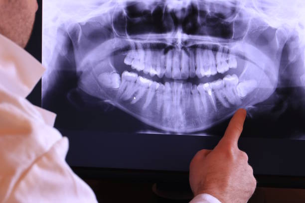Best Emergency Denture Repair in Falmouth, VA