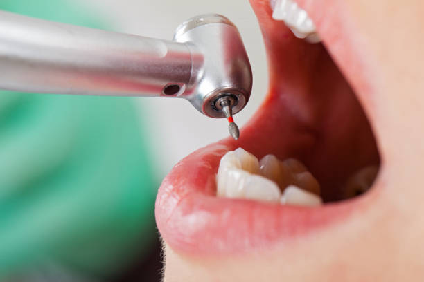 Professional Emergency Dental Service in VA